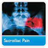 sacroiliac pain