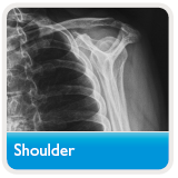 shoulder xray